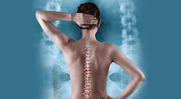 Pilates and osteoporosis